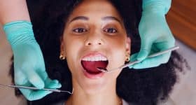 microbiote-buccal-quelle-importance-alimentation